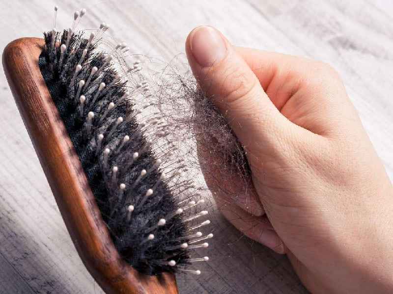 Is hair loss a symptom of psoriatic arthritis