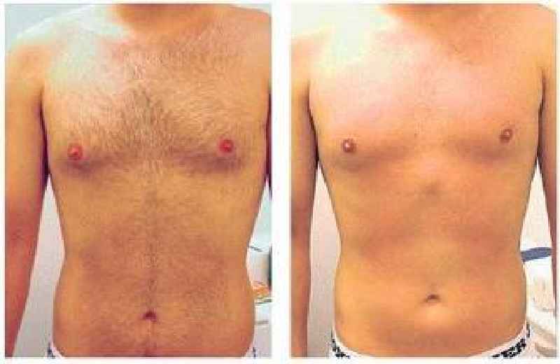 Is it better to wax or shave your chest