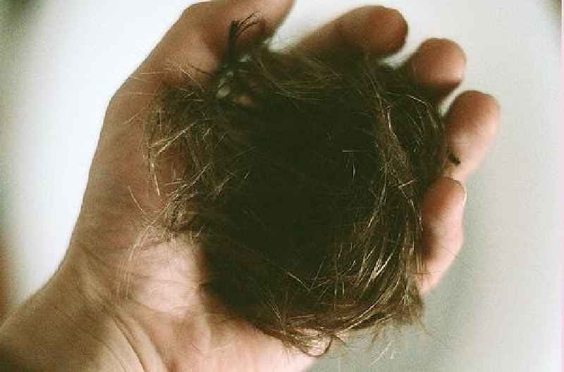 Is it normal to lose 150 hairs a day