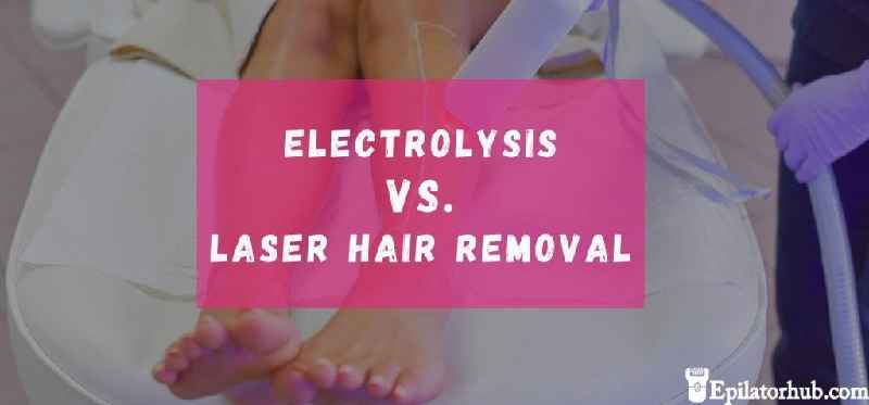 Is laser or electrolysis better for PCOS