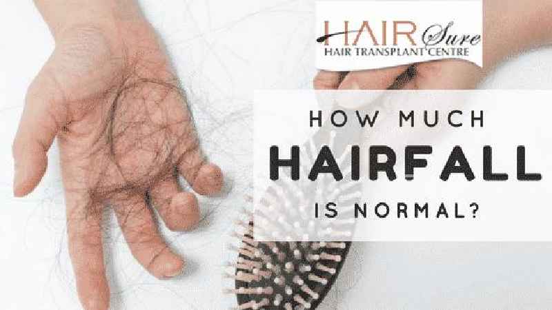 Is losing 150 hairs a day normal