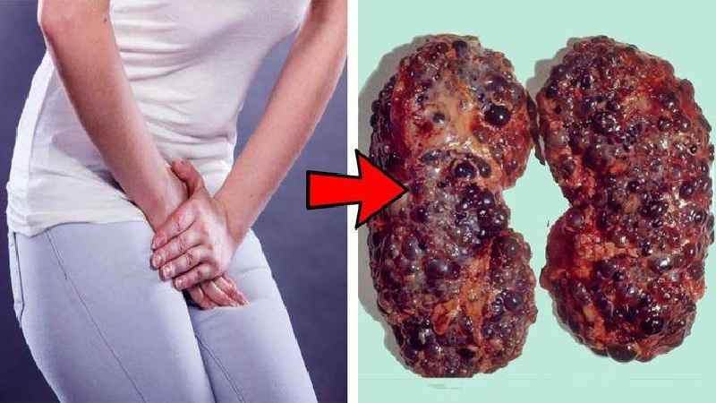 Is Metamucil bad for kidneys