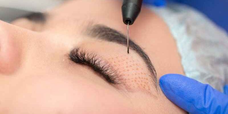 Is PRP a cosmetic treatment