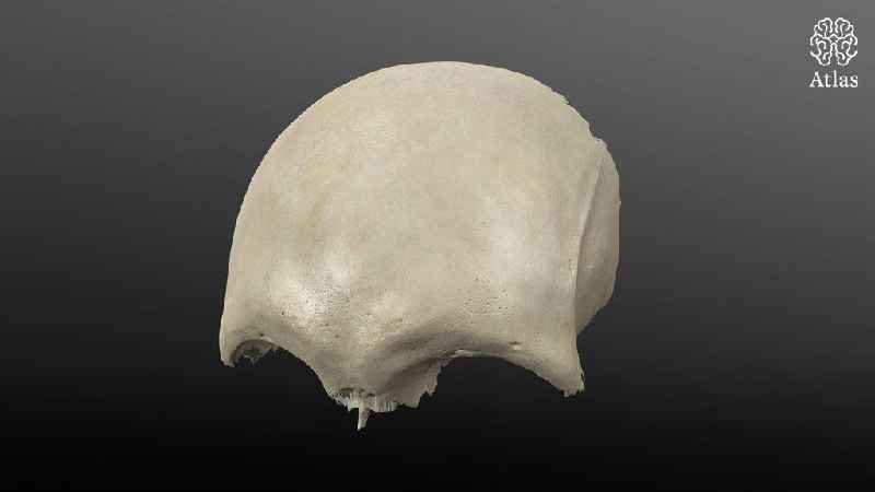 Is the frontal bone a facial bone
