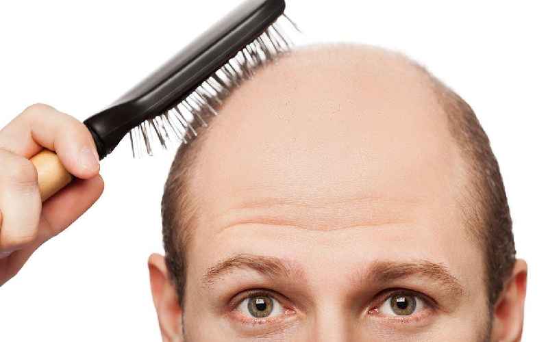 Is there a natural way to stop hair loss