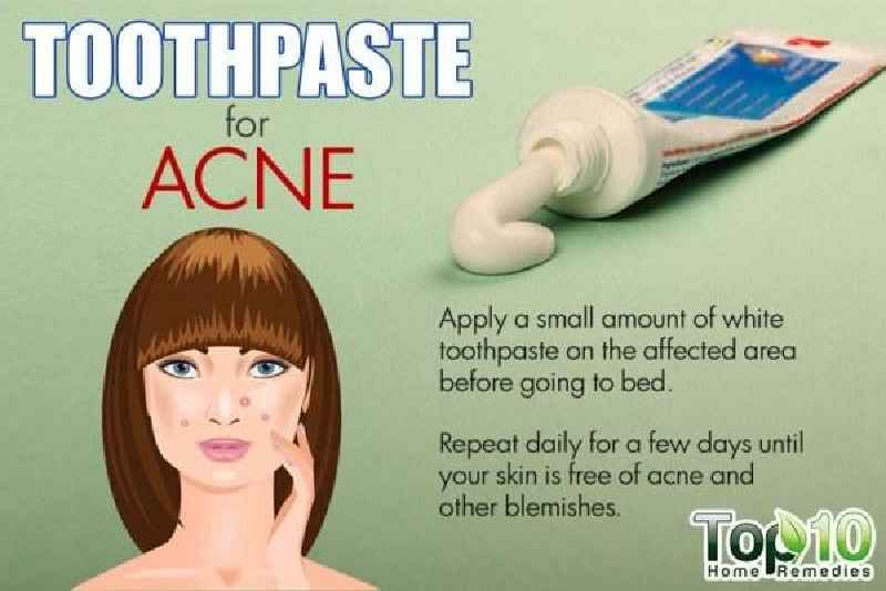 Is toothpaste good for acne
