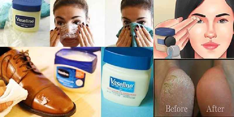 Is Vaseline good after a chemical peel