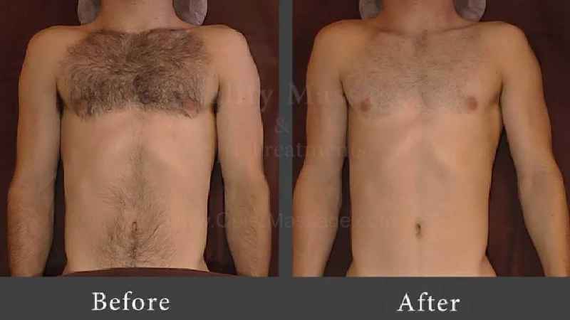 Should I shave my body hair female