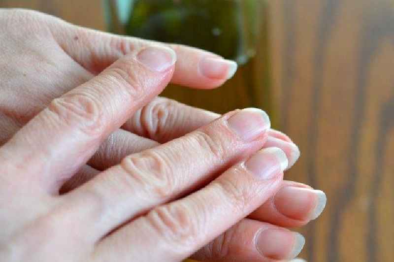 Should you remove a damaged fingernail