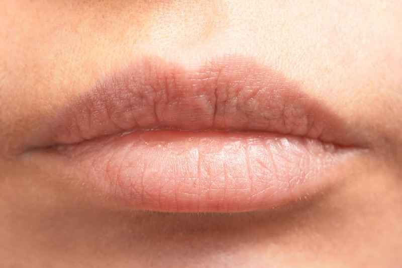 Should you wax your upper lip