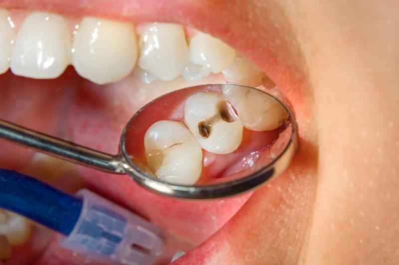 What affects oral health