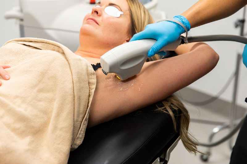 What age is recommended for laser hair removal