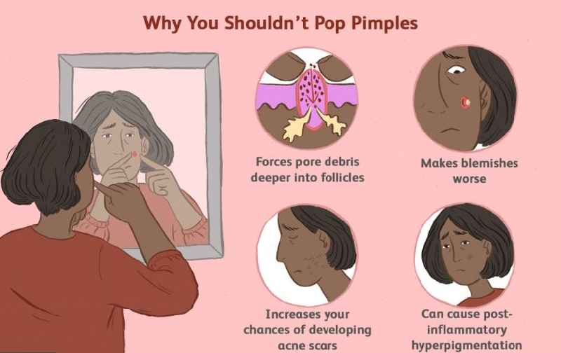 What age pimples stop