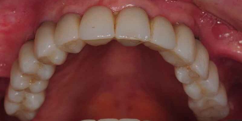 What are considered dental cosmetic procedures