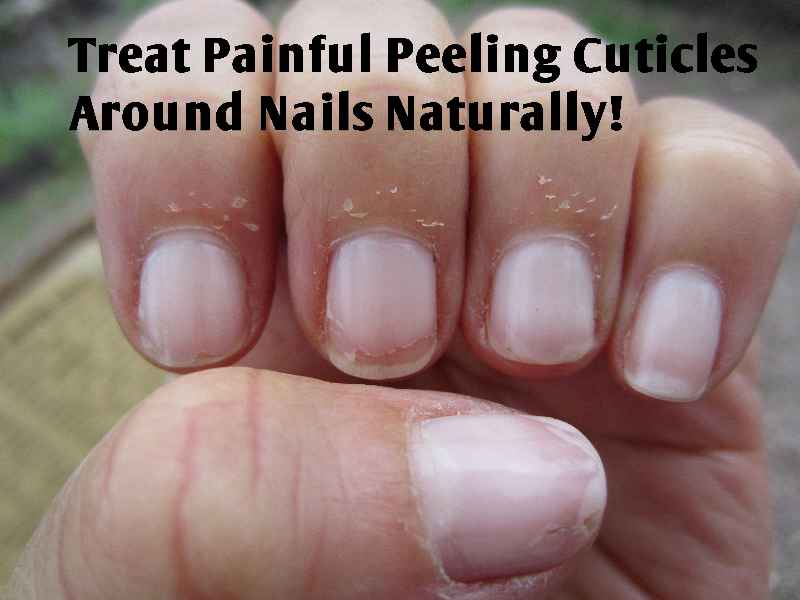 What are cuticle nippers used for