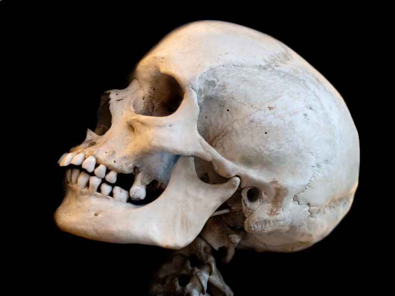 What are the 29 bones of the skull