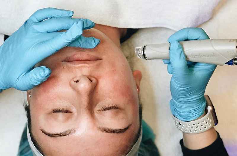 What are the dangers of facial fillers