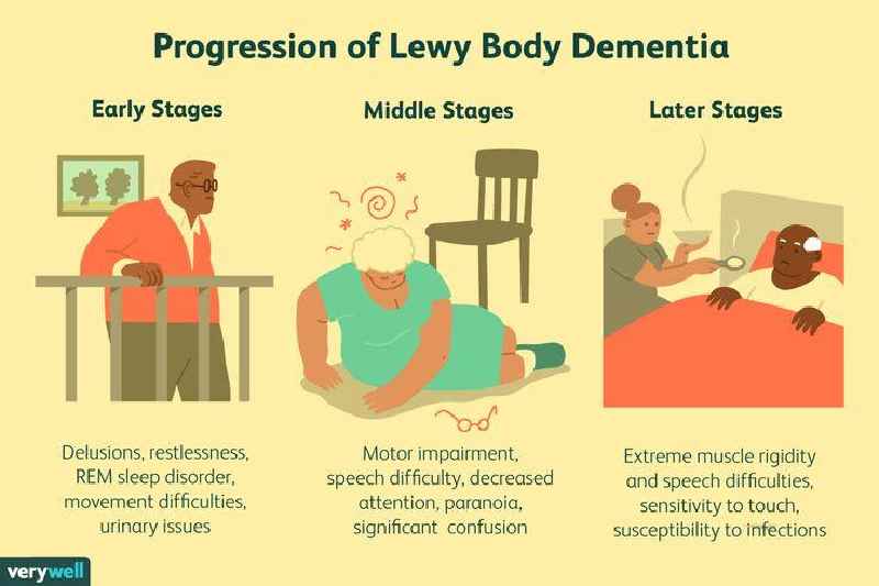 What are the end stages of Lewy body dementia