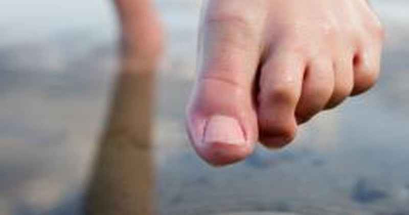What are the symptoms of a sprained big toe