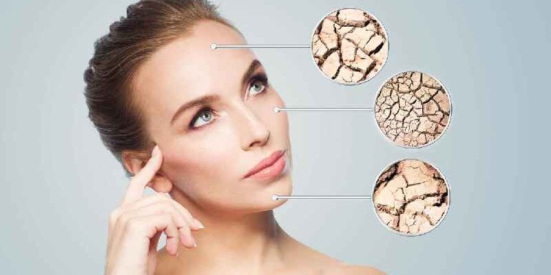 What causes dry face