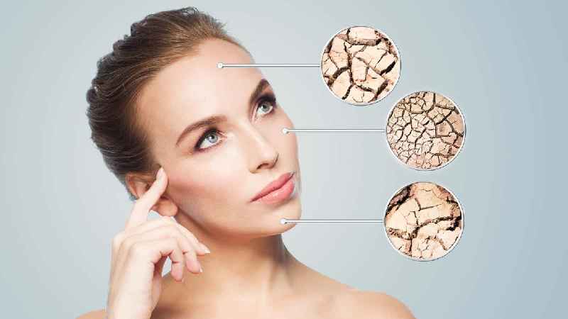 What causes dry face