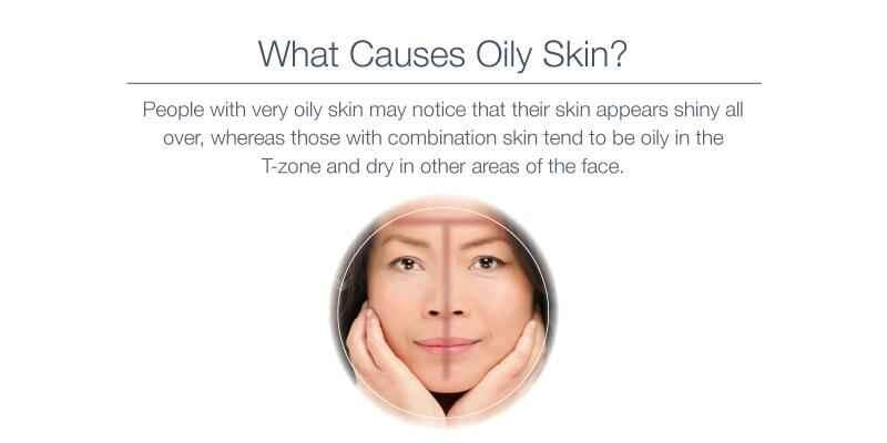 What causes oily face
