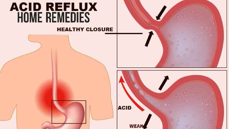 What causes the let down reflex