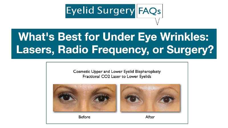 What cosmetic procedure is the best for under eye wrinkles