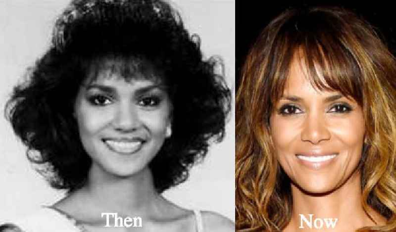 What cosmetic surgery has Halle Berry had