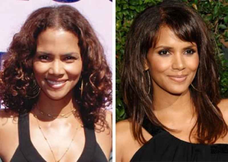 What cosmetic surgery has Halle Berry had