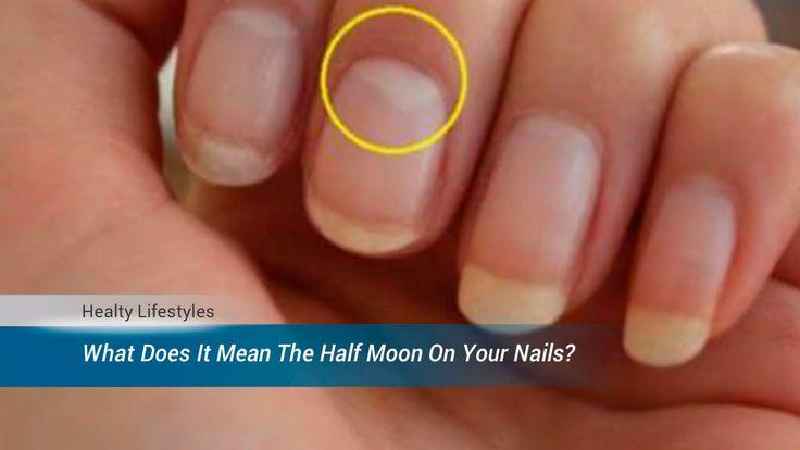 What do moons on fingernails mean