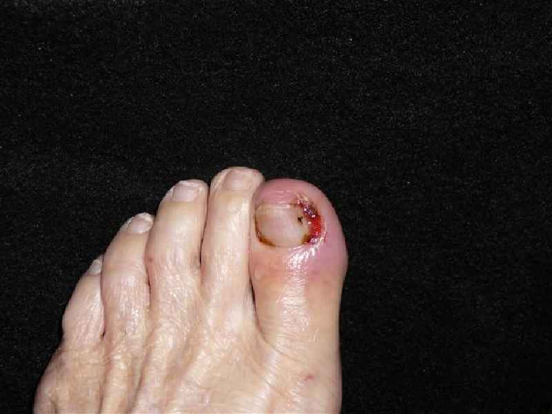What doctor treats nail bed injury