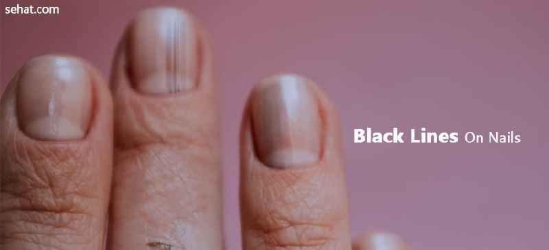 What does a painted black thumb nail mean