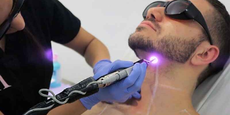 What does full body laser removal include
