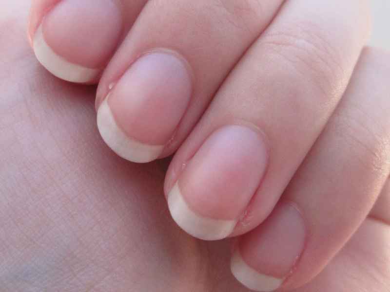 What does purple half moons on fingernails mean