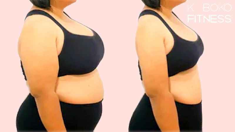 What does your BMI have to be to get a breast reduction