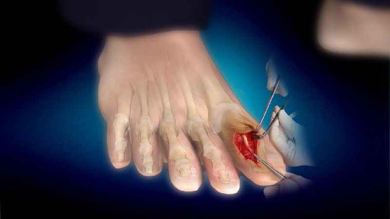 What happens if you break your big toe