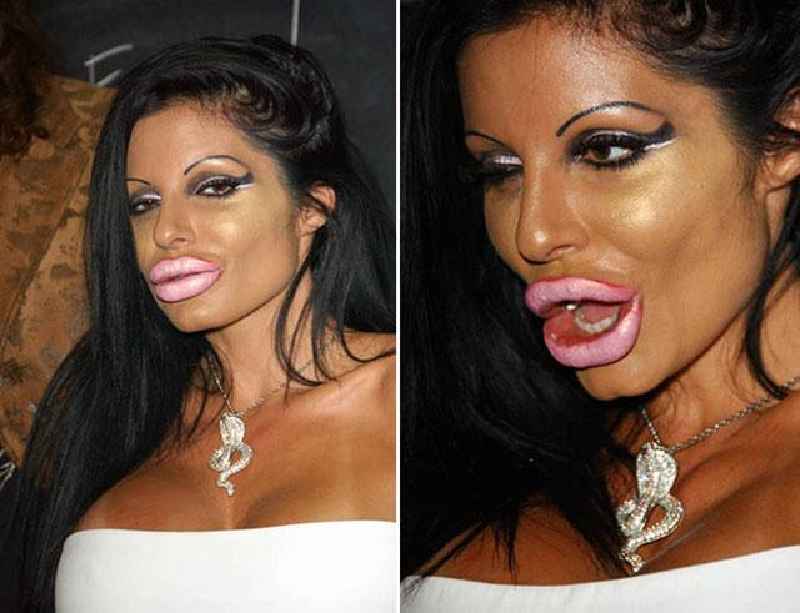 What happens when you get too much plastic surgery