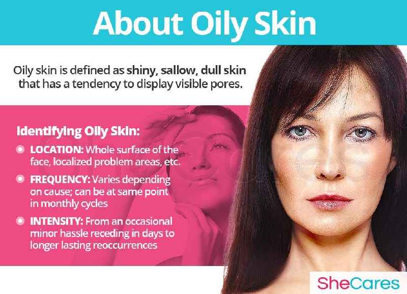 What hormone causes oily skin