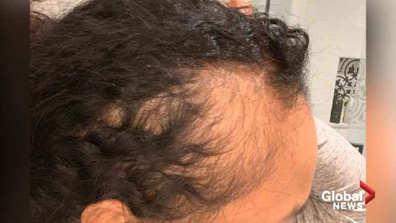 What ingredient in DevaCurl causes hair loss