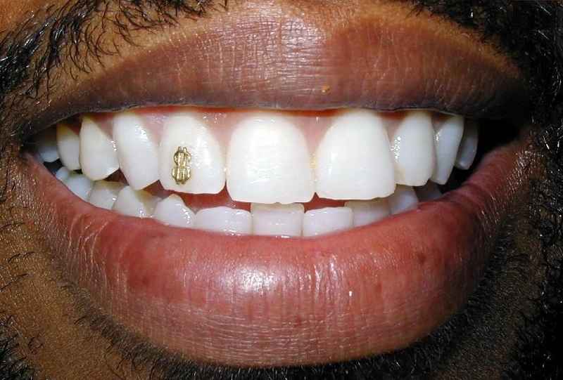 What is basic dental