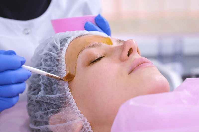 What is better chemical peel or microneedling
