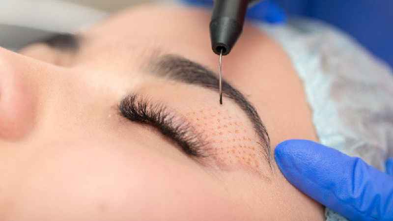 What is considered a cosmetic procedure