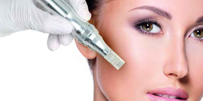 What is newest laser treatment for face