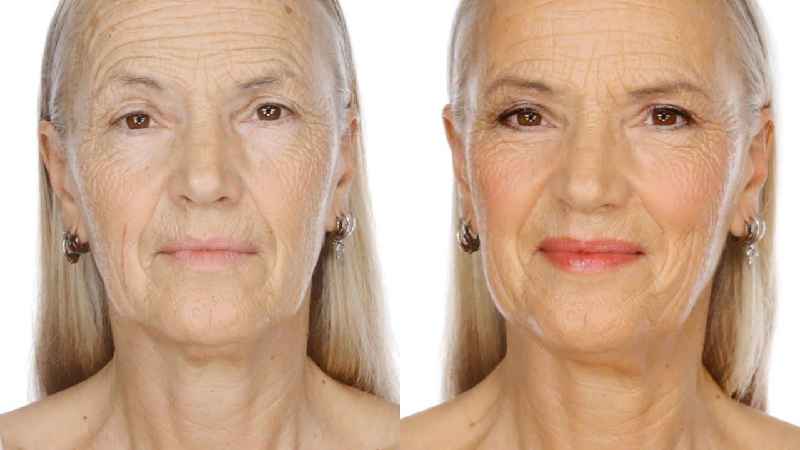 What is the best treatment for 70 year old skin