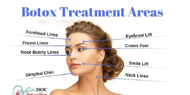 What is the best treatment for horizontal neck lines