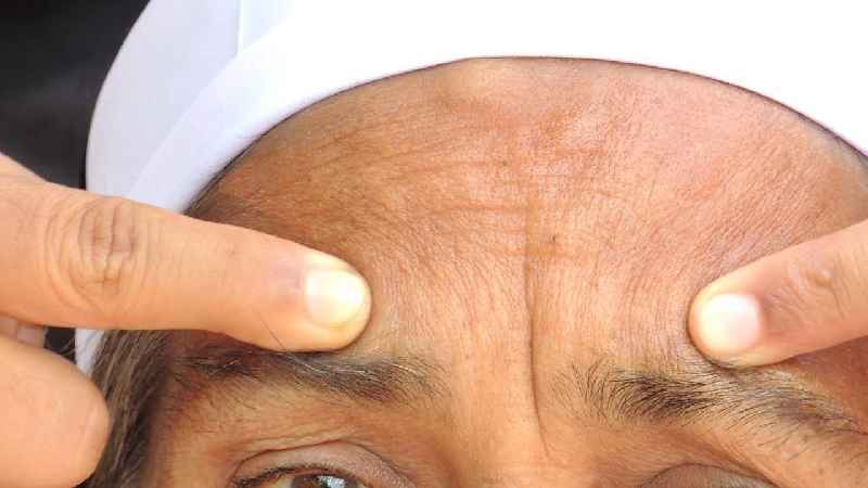 What is the best treatment for wrinkles and sagging skin
