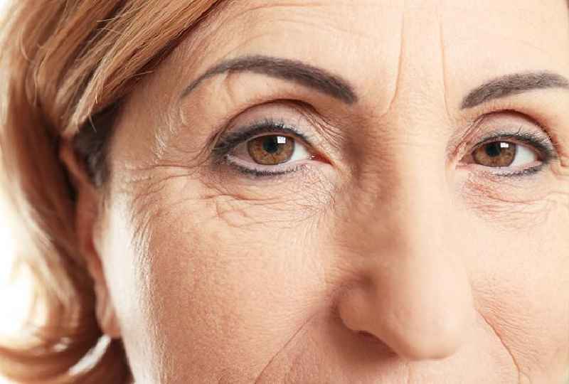 What is the best treatment for wrinkles and sagging skin