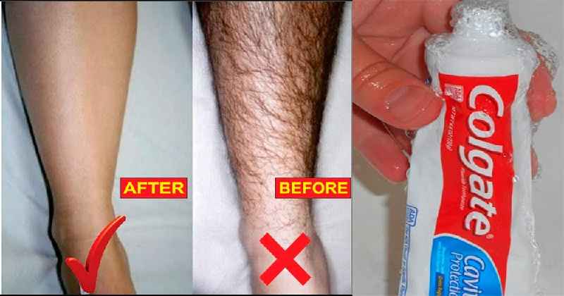 What is the best way to remove male body hair