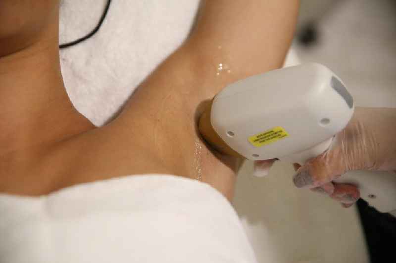 What is the cost of laser hair removal in India